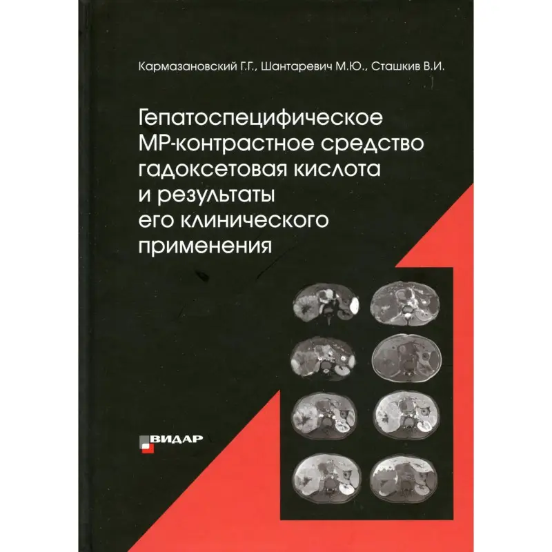 Уценка. Кармазановский Г.Г. и др. Гепатоспецифическое МР-контрастное средство «гадоксетовая кислота» и результаты его клинического применения