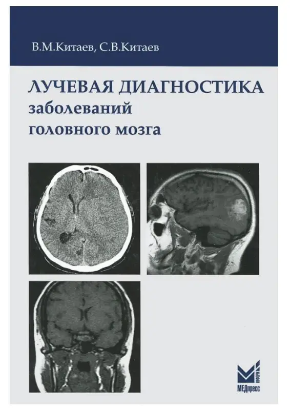 Лучевая диагностика заболеваний головного мозга
