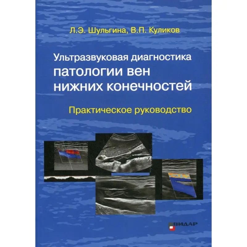 Уценка. Ультразвуковая диагностика патологии вен нижних конечностей.
